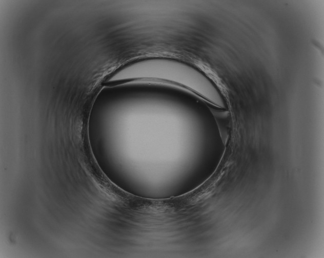 X0000091170201200709060941