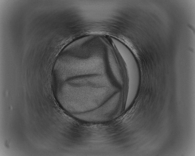 X0000091170385200709060938