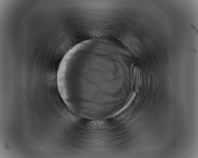 X0000091170526200709060936