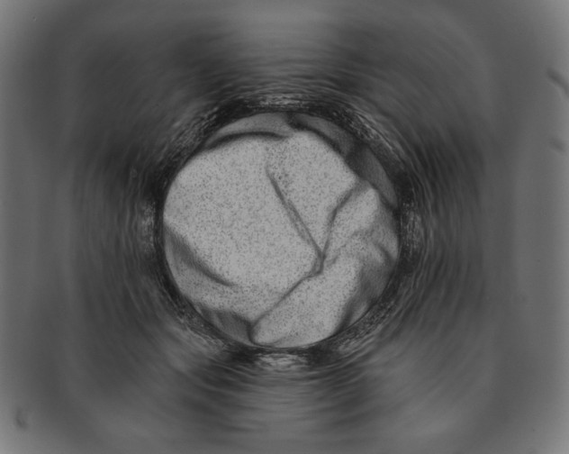 X0000091170557200709060936