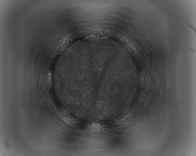 X0000091170598200709060935