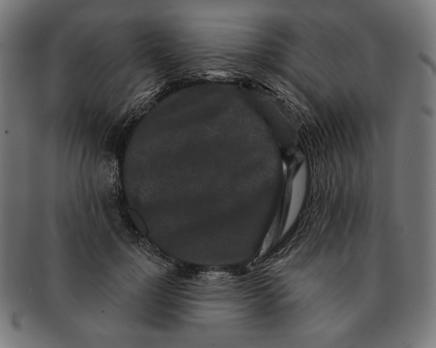 X0000091170748200709060933