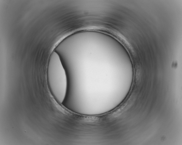 X0000091181417200708091036