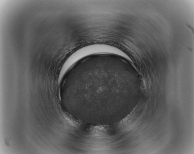 X0000091180180200708161525