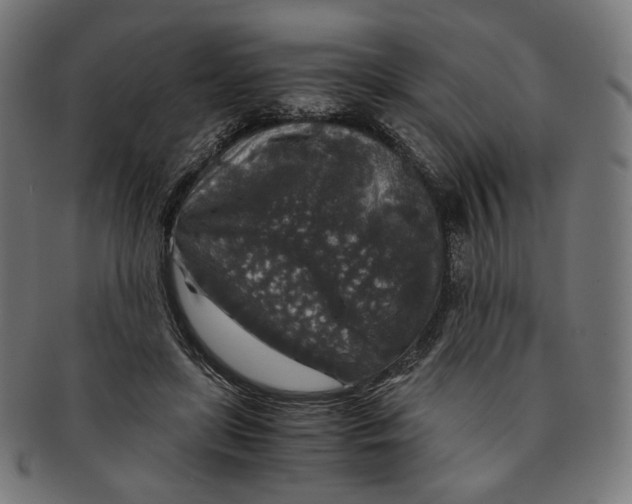 X0000091180451200709060957