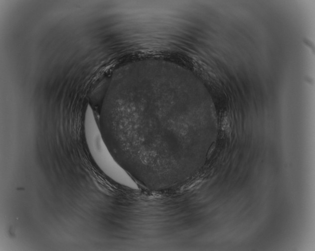 X0000091180868200709060952