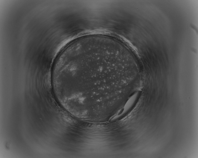 X0000091181174200709060948