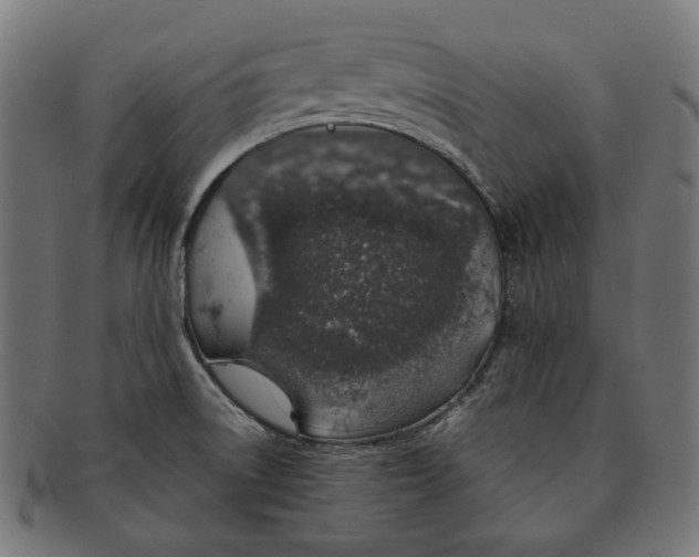 X0000091181522200709060944