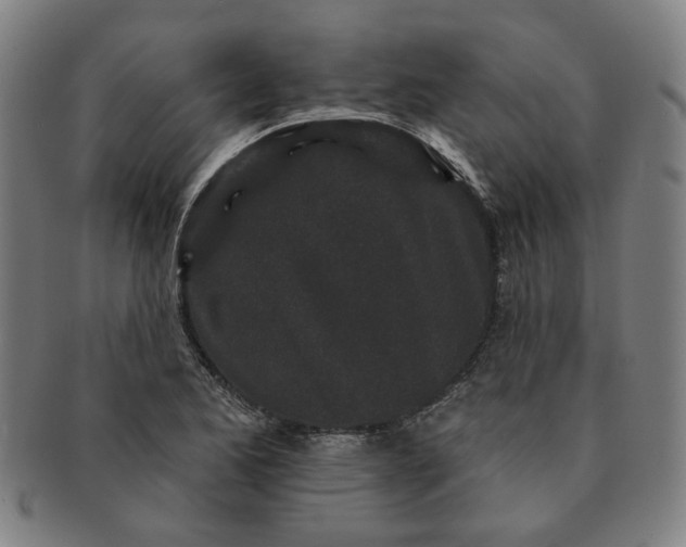 X0000091191173200708231502