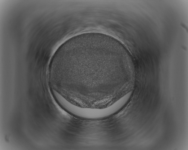 X0000091191519200709061003