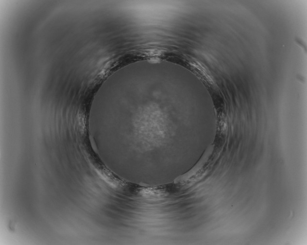 X0000091200568200708161617