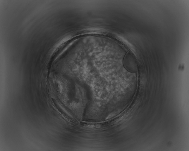 X0000091201411200708301551