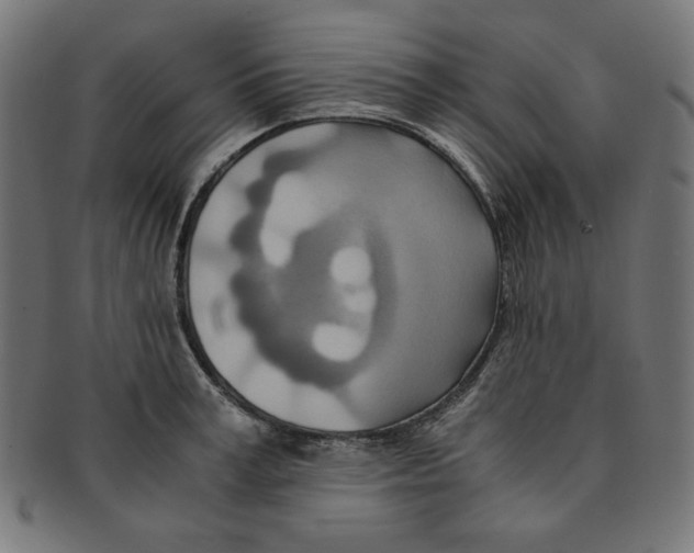 X0000091200995200709061410