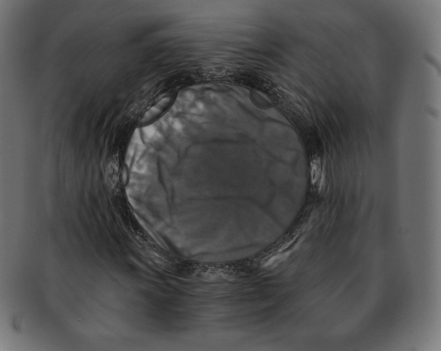 X0000091201011200709061409