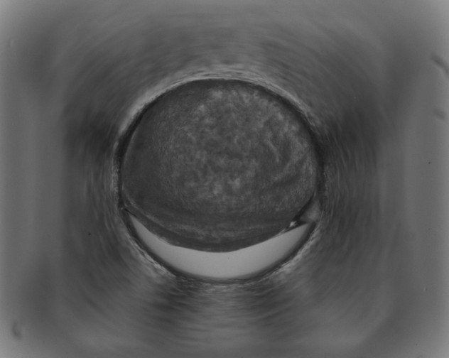 X0000091201506200709061403