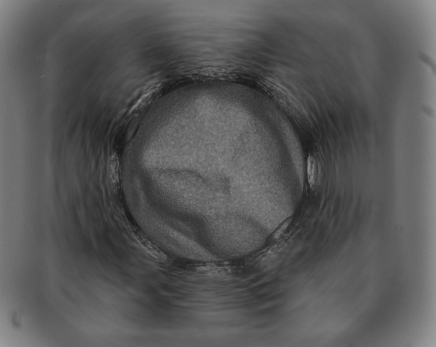 X0000091211107200708301422