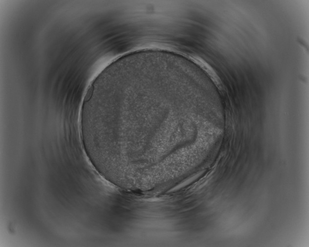 X0000091211199200709061433