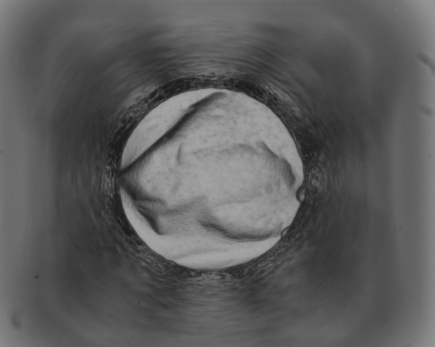 X0000091240869200709061538
