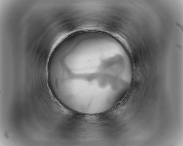 X0000091291191200708171338