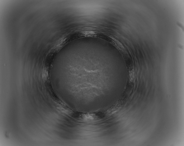 X0000091290618200708241030