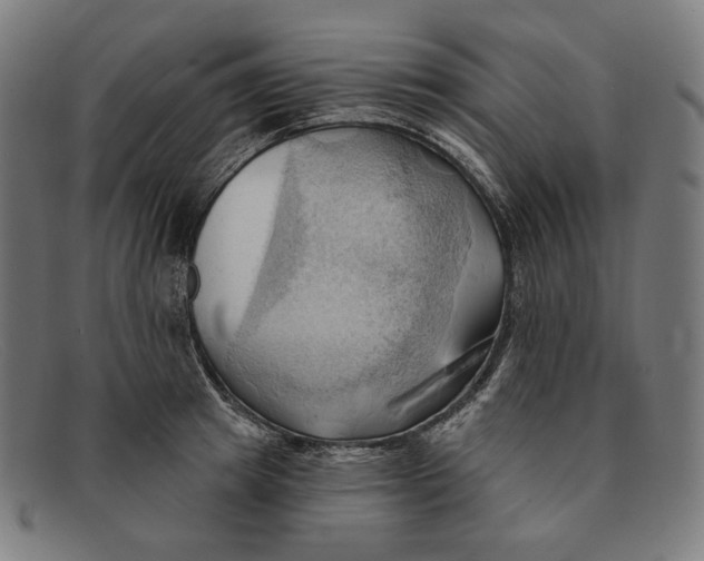 X0000091290849200708311315