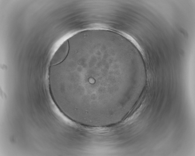 X0000091311387200708101455