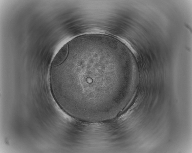 X0000091311387200708171405