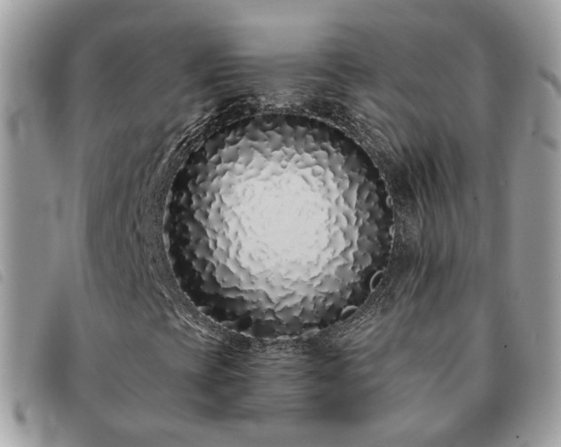 X0000091311393200708171404