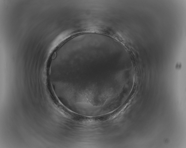 X0000091330198200708171358