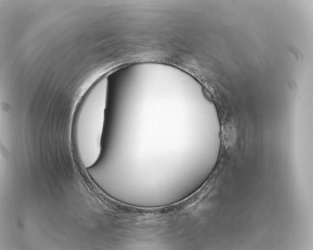 X0000091340196200708101025