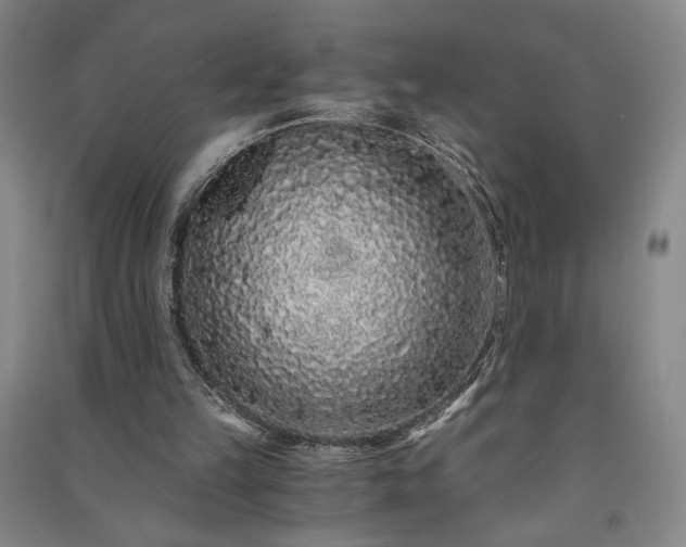 X0000091340149200708171418