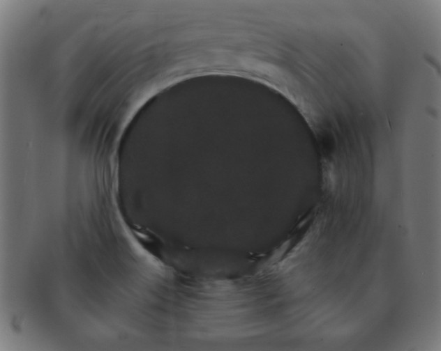 X0000091341515200708241212