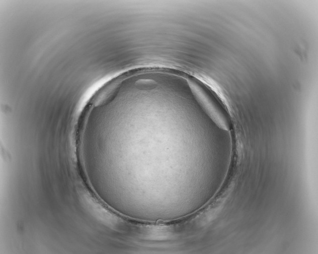 X0000091351120200708101525