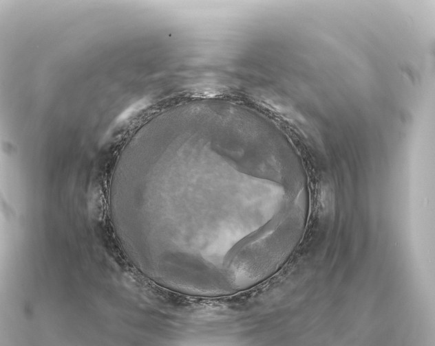 X0000091351446200708101520