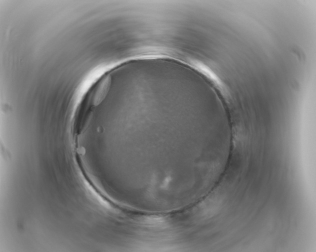 X0000091351472200708101520