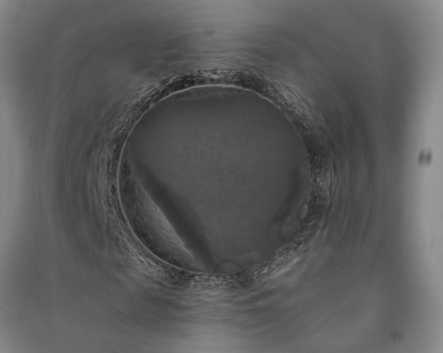 X0000091350817200708171429