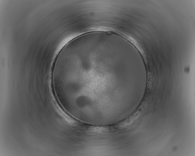 X0000091351187200708171425