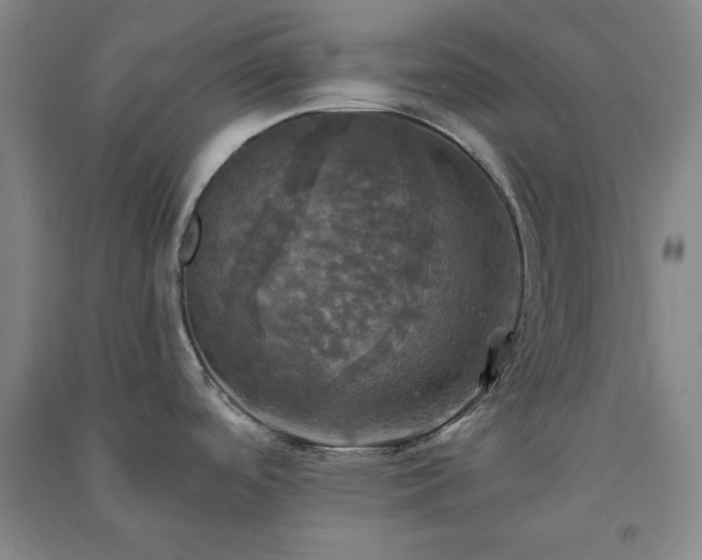 X0000091351488200708171421