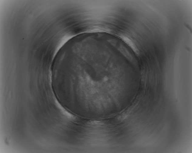 X0000091351476200708241235