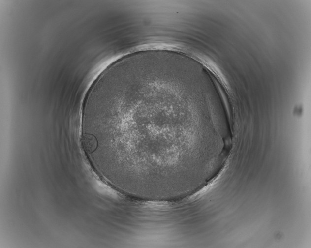 X0000091360844200708101418