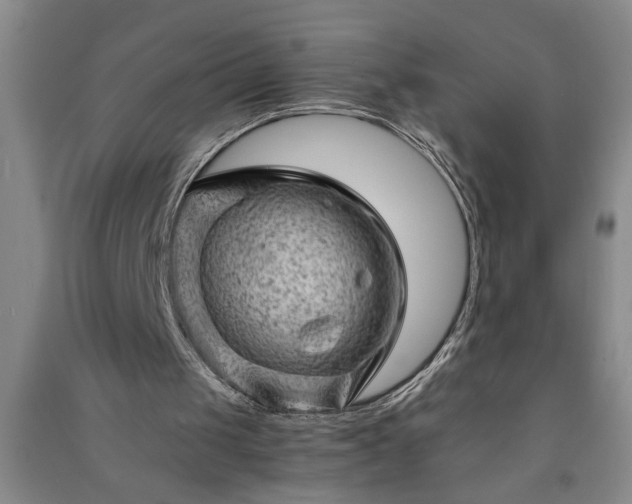 X0000091360049200708171532