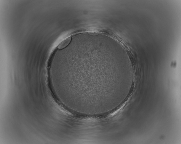 X0000091360198200708171531