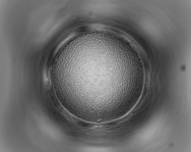 X0000091371198200708171538