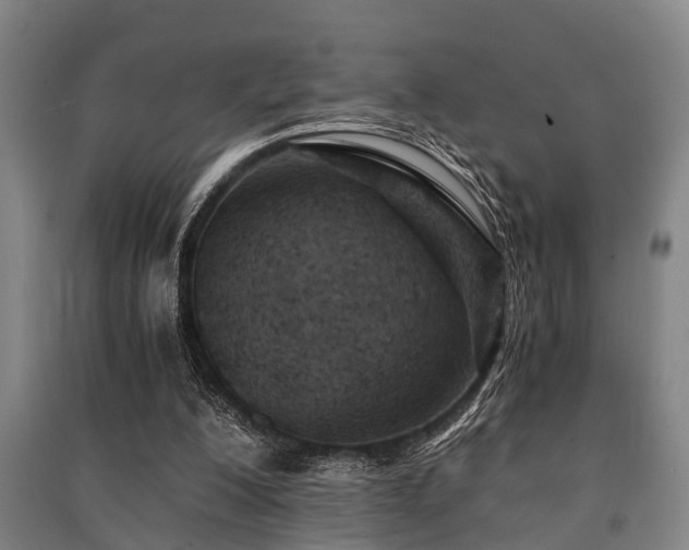 X0000091450200200708161305