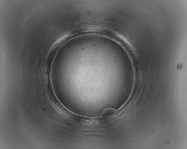 X0000091451403200708161249