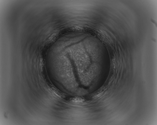 X0000091450223200709131721