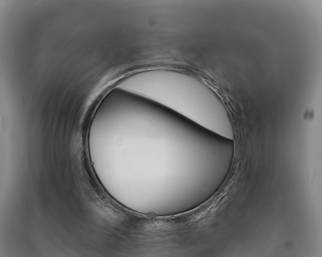 X0000091460198200708161114