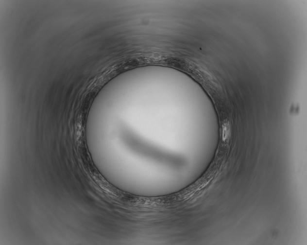 X0000091461011200708161103