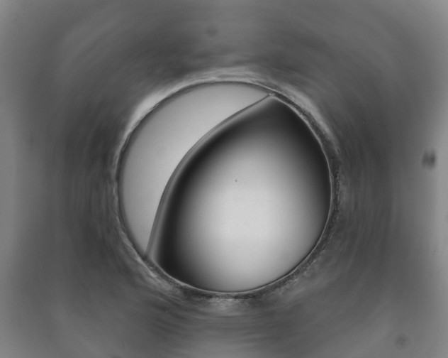 X0000091461176200708161101