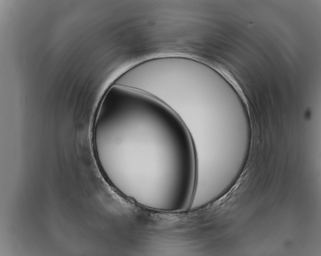 X0000091461197200708161101